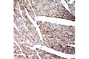 Anti-Gelsolin antibody, IHC(P) IHC(P): Rat Cardiac Muscle Tissue