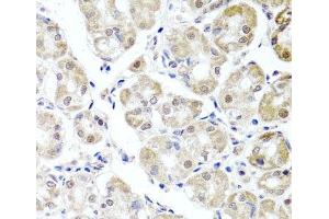 Immunohistochemistry of paraffin-embedded Human stomach using ALKBH4 Polyclonal Antibody at dilution of 1:100 (40x lens). (ALKBH4 anticorps)
