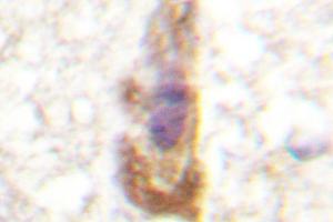 Image no. 1 for anti-Protein Kinase C, zeta (PRKCZ) antibody (ABIN272064) (PKC zeta anticorps)