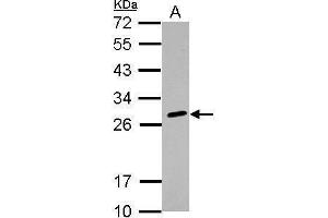 WB Image Sample (30 ug of whole cell lysate) A: K562 12% SDS PAGE antibody diluted at 1:1000 (HLA-DQB2 anticorps)