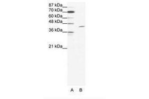 Image no. 1 for anti-T-Cell Acute Lymphocytic Leukemia 1 (TAL1) (C-Term) antibody (ABIN202265) (TAL1 anticorps  (C-Term))