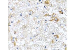 Immunohistochemistry of paraffin-embedded Rat brain using ABCB8 Polyclonal Antibody at dilution of 1:100 (40x lens). (ABCB8 anticorps)