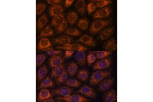 Immunofluorescence analysis of HeLa cells using CCT6B antibody (ABIN7270709) at dilution of 1:100.