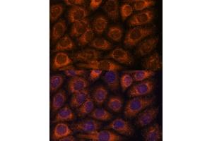 Immunofluorescence analysis of HeLa cells using CCT6B antibody (ABIN7270709) at dilution of 1:100. (CCT6B anticorps  (AA 120-340))