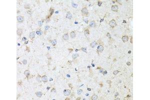 Immunohistochemistry of paraffin-embedded Mouse brain using KLK11 Polyclonal Antibody at dilution of 1:100 (40x lens).