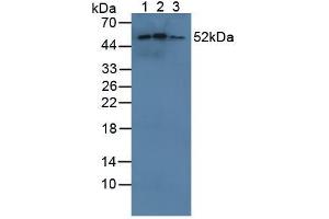 Figure. (CYP21A2 anticorps  (AA 37-264))