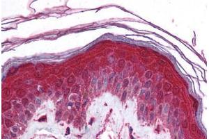 Human Skin (formalin-fixed, paraffin-embedded) stained with KCNN3 antibody ABIN214788 at 5 ug/ml followed by biotinylated goat anti-rabbit IgG secondary antibody ABIN481713, alkaline phosphatase-streptavidin and chromogen.