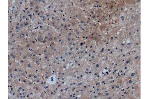 Detection of CCL27 in Human Liver Tissue using Monoclonal Antibody to Chemokine (C-X-C Motif) Ligand 27 (CCL27)