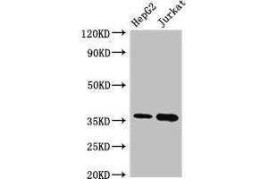Western Blot Positive WB detected in: HepG2 whole cell lysate, Jurkat whole cell lysate All lanes: TYMS antibody at 2.