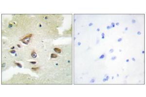 Immunohistochemistry analysis of paraffin-embedded human brain tissue using CLUS antibody. (Clusterin anticorps  (C-Term))