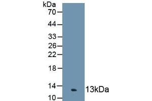 Detection of Recombinant C4c, Human using Polyclonal Antibody to Complement Component 4c (C4c) (Complement C4c anticorps  (AA 19-333))