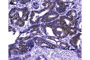 IHC analysis of GOLPH3 using anti-GOLPH3 antibody (ABIN6719570).