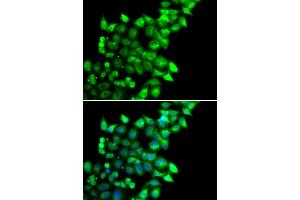Immunofluorescence analysis of U20S cell using MEST antibody. (MEST anticorps)