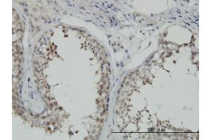 Immunoperoxidase of monoclonal antibody to HSPA1B on formalin-fixed paraffin-embedded human testis.
