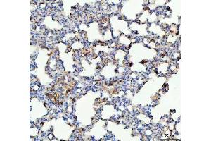 anti-Glutathione Peroxidase 1 (GPX1) (AA 116-146), (Middle Region) antibody