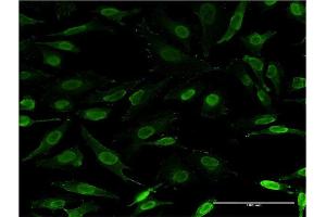 Immunofluorescence of monoclonal antibody to IKZF3 on HeLa cell.