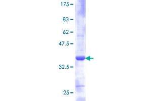 Image no. 1 for Ribosomal Protein S21 (RPS21) (AA 1-81) protein (GST tag) (ABIN1318772)