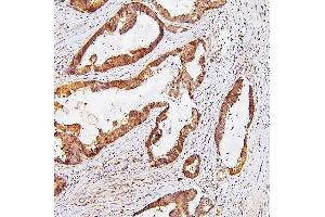 IHC analysis of TDRD3 using anti-TDRD3 antibody (ABIN6719636).