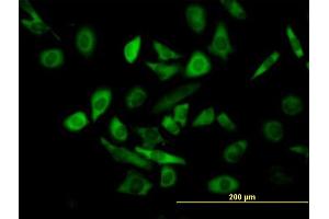 Immunofluorescence of purified MaxPab antibody to TRIM25 on HeLa cell. (TRIM25 anticorps  (AA 1-630))