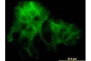 Image no. 2 for anti-Protocadherin 1 (PCDH1) (AA 62-170) antibody (ABIN598857) (Protocadherin 1 anticorps  (AA 62-170))