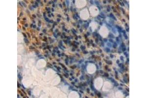 Used in DAB staining on fromalin fixed paraffin-embedded rectum tissue (FAM3D anticorps  (AA 26-224))