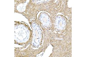 Immunohistochemistry of paraffin-embedded rat ovary using Collagen I/COL1 Rabbit pAb (352) at dilution of 1:150 (40x lens). (COL1A1 anticorps  (AA 100-200))