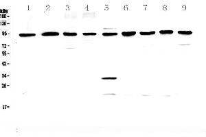 Western blot analysis of GNS using anti-GNS antibody .