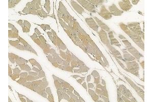 ABIN6258905 and ABIN6273508 at 1/100 staining human tongue carcinoma by IHC-P.