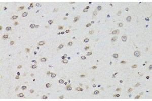 Immunohistochemistry of paraffin-embedded Mouse brain using TMPO Polyclonal Antibody at dilution of 1:100 (40x lens). (Thymopoietin anticorps)