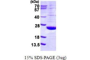 SDS-PAGE (SDS) image for Dual Specificity Phosphatase 21 (DUSP21) (AA 1-190) protein (His tag) (ABIN668019)
