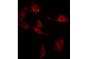 ABIN6269364 staining HuvEc by IF/ICC.