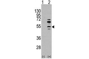 Western blot analysis of MEF2C antibody and 293 cell lysate (2 ug/lane) either nontransfected (Lane 1) or transiently transfected with the MEF2C gene (2). (MEF2C anticorps  (AA 37-66))