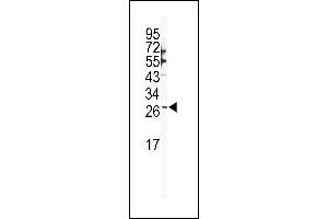 Western blot analysis of SNAI1 Antibody (N-term R8) (ABIN388810 and ABIN2839128) in NCI- cell line lysates (35 μg/lane). (SNAIL anticorps  (N-Term))