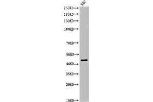 Western Blot analysis of VEC cells using Cleaved-Plasma Kallikrein HC (R390) Polyclonal Antibody (KLKB1 anticorps  (Cleaved-Arg390))