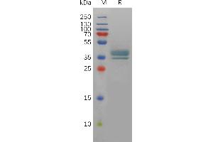 Human PT Protein, hFc Tag on SDS-PAGE under reducing condition.