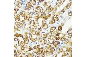 Immunohistochemistry of paraffin-embedded human stomach using S1/PR antibody (ABIN6129890, ABIN6136741, ABIN6136742 and ABIN6221835) at dilution of 1:200 (40x lens).