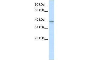 WB Suggested Anti-NEUROD6 Antibody Titration:  0. (NEUROD6 anticorps  (N-Term))