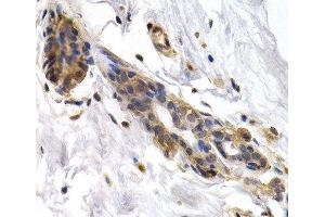 Immunohistochemistry of paraffin-embedded Human normal breast using PKLR Polyclonal Antibody at dilution of 1:200 (40x lens). (PKLR anticorps)