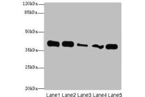 Western blot All lanes: KHDRBS2 antibody at 7 μg/mL Lane 1: K562 whole cell lysate Lane 2: Hela whole cell lysate Lane 3: A431 whole cell lysate Lane 4: Jurkat whole cell lysate Lane 5: NIH/3T3 whole cell lysate Secondary Goat polyclonal to rabbit IgG at 1/10000 dilution Predicted band size: 39 kDa Observed band size: 39 kDa