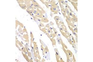 Immunohistochemistry of paraffin-embedded mouse heart using CCT3 antibody at dilution of 1:100 (x40 lens). (CCT3 anticorps)