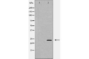 Western blot analysis of Hela whole cell lysates, using RAB11A  Antibody. (RAB11A anticorps  (C-Term))