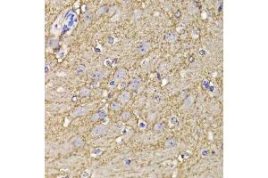 Immunohistochemistry of paraffin-embedded mouse brain using KCND3 antibody. (KCND3 anticorps  (AA 502-636))