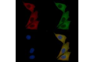 c-Kit Mouse Monoclonal Antibody staining Hela cells by IF/ICC. (KIT anticorps  (Internal Region))