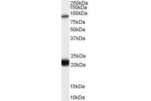 Western Blotting (WB) image for anti-RAS Protein Activator Like 1 (GAP1 Like) (RASAL1) (AA 794-806) antibody (ABIN292170) (RASAL1 anticorps  (AA 794-806))