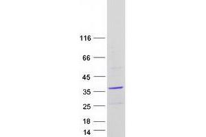Validation with Western Blot