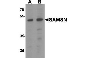 Western Blotting (WB) image for anti-SAM Domain, SH3 Domain and Nuclear Localization Signals, 1 (SAMSN1) (C-Term) antibody (ABIN1077391) (SAMSN1 anticorps  (C-Term))