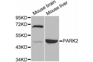 Western blot analysis of extracts of various cell lines, using PARK2 antibody (ABIN5998454) at 1/1000 dilution. (Parkin anticorps)