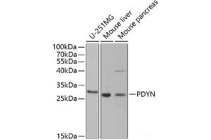 Western blot analysis of extracts of various cell lines using PDYN Polyclonal Antibody at dilution of 1:1000. (PDYN anticorps)