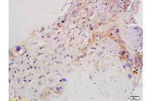 Formalin-fixed and paraffin embedded human placenta labeled with Rabbit Anti CYP19/CYP19A1 Polyclonal Antibody, Unconjugated (ABIN674529) at 1:200 followed by conjugation to the secondary antibody and DAB staining (Aromatase anticorps  (AA 41-140))