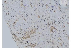 ABIN6274652 at 1/100 staining Human lung tissue by IHC-P. (CYP2S1 anticorps  (Internal Region))